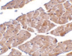 Invitrogen TRPC3 Polyclonal Antibody 100 &mu;g; Unconjugated:Antibodies,