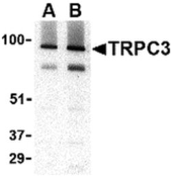 Invitrogen TRPC3 Polyclonal Antibody 100 &mu;g; Unconjugated:Antibodies,