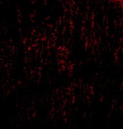 Invitrogen TANK Polyclonal Antibody 100 &mu;g | Buy Online | Invitrogen&trade; | Fisher Scientific