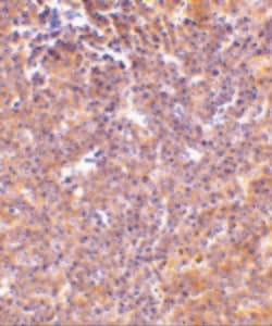 PAK2 Polyclonal Antibody, Invitrogen 100 &mu;g; Unconjugated:Antibodies,