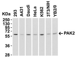 PAK2 Polyclonal Antibody, Invitrogen 100 &mu;g; Unconjugated:Antibodies,