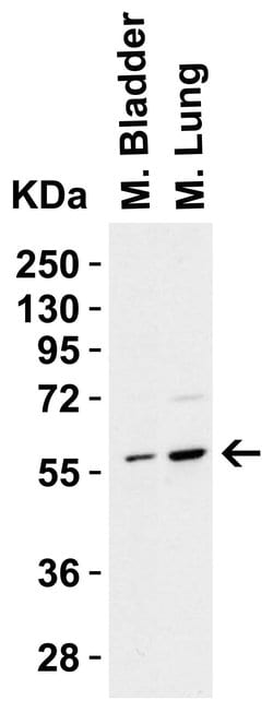 PAK2 Polyclonal Antibody, Invitrogen 100 &mu;g; Unconjugated:Antibodies,