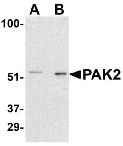 PAK2 Polyclonal Antibody, Invitrogen 100 &mu;g; Unconjugated:Antibodies,