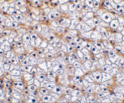 Invitrogen CD266 Polyclonal Antibody 100 &mu;g; Unconjugated:Antibodies,