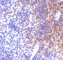 Invitrogen IRF7 Polyclonal Antibody 100 &mu;g; Unconjugated:Antibodies,