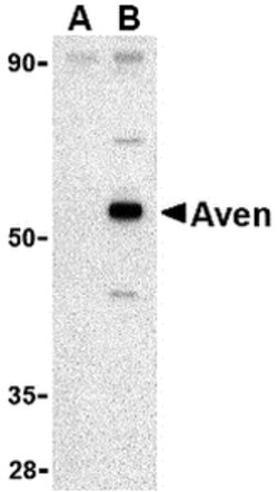 Invitrogen AVEN Polyclonal Antibody 100 &mu;g | Buy Online | Invitrogen&trade; | Fisher Scientific