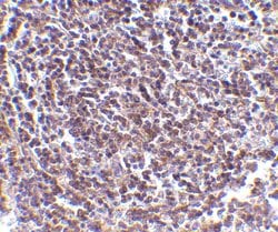 Invitrogen AVEN Polyclonal Antibody 100 &mu;g | Buy Online | Invitrogen&trade; | Fisher Scientific
