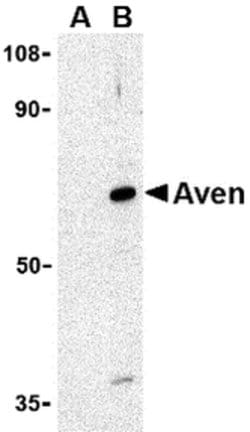 Invitrogen AVEN Polyclonal Antibody 100 &mu;g | Buy Online | Invitrogen&trade; | Fisher Scientific