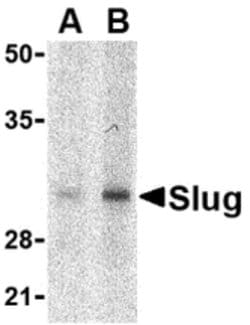 Invitrogen SLUG Polyclonal Antibody 100 &mu;g; Unconjugated:Antibodies,