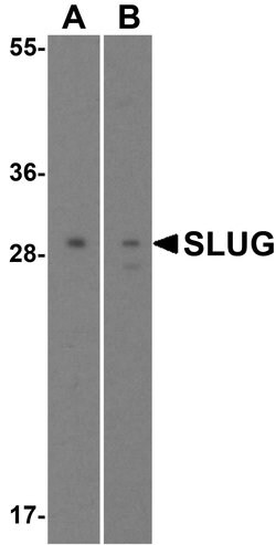 Invitrogen SLUG Polyclonal Antibody 100 &mu;g; Unconjugated:Antibodies,