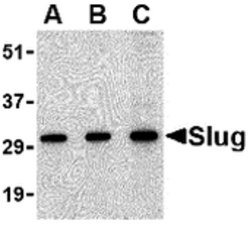 Invitrogen SLUG Polyclonal Antibody 100 &mu;g; Unconjugated:Antibodies,