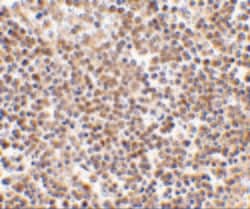 Invitrogen HSL Polyclonal Antibody 100 &mu;g; Unconjugated:Antibodies,