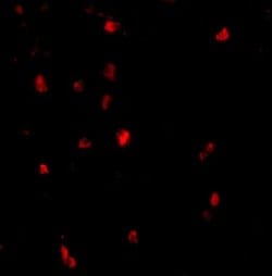 Invitrogen c-Cbl Polyclonal Antibody 100 &mu;g; Unconjugated:Antibodies,