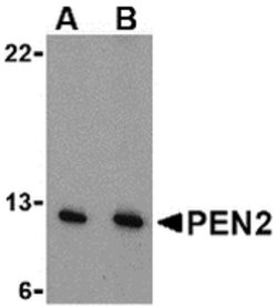 Invitrogen PEN2 Polyclonal Antibody 100 &mu;g; Unconjugated:Antibodies,