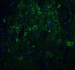 Nicastrin Polyclonal Antibody, Invitrogen 100 &mu;g; Unconjugated:Antibodies