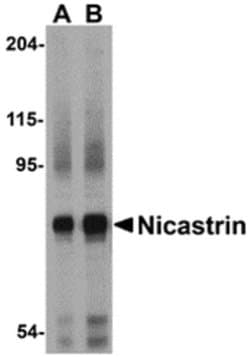 Nicastrin Polyclonal Antibody, Invitrogen 100 &mu;g; Unconjugated:Antibodies