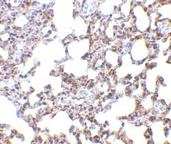 Invitrogen SnoN Polyclonal Antibody 100 &mu;g; Unconjugated:Antibodies,