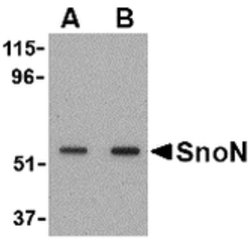 Invitrogen SnoN Polyclonal Antibody 100 &mu;g; Unconjugated:Antibodies,