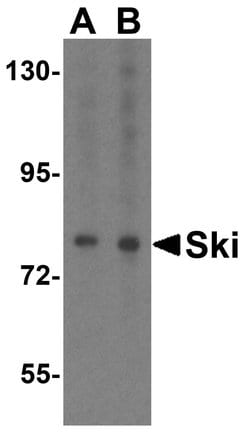 Invitrogen SKI Polyclonal Antibody 100 &mu;g; Unconjugated:Antibodies,