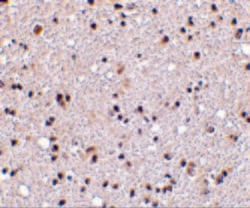 TMP21 Polyclonal Antibody, Invitrogen 100 &mu;g; Unconjugated:Antibodies