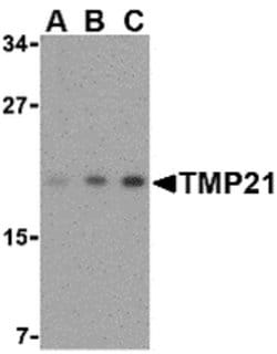TMP21 Polyclonal Antibody, Invitrogen 100 &mu;g; Unconjugated:Antibodies