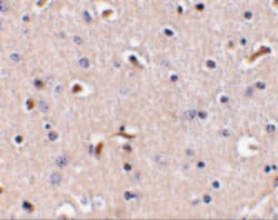 Invitrogen APH1 Polyclonal Antibody 100 &mu;g | Buy Online | Invitrogen&trade; | Fisher Scientific