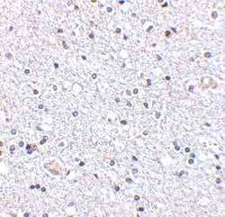 Invitrogen TSLP Polyclonal Antibody 100 &mu;g; Unconjugated:Antibodies,