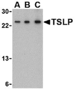 Invitrogen TSLP Polyclonal Antibody 100 &mu;g; Unconjugated:Antibodies,