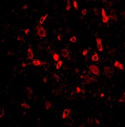 Invitrogen TSLP Polyclonal Antibody 100 &mu;g; Unconjugated:Antibodies,