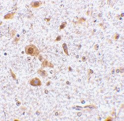 Invitrogen TSLP Polyclonal Antibody 100 &mu;g; Unconjugated:Antibodies,