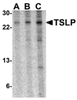 Invitrogen TSLP Polyclonal Antibody 100 &mu;g; Unconjugated:Antibodies,