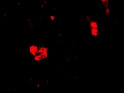 Invitrogen CIDEB Polyclonal Antibody 100 &mu;g; Unconjugated:Antibodies,