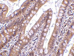 Invitrogen CIDEB Polyclonal Antibody 100 &mu;g; Unconjugated:Antibodies,