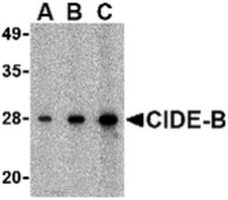 Invitrogen CIDEB Polyclonal Antibody 100 &mu;g; Unconjugated:Antibodies,