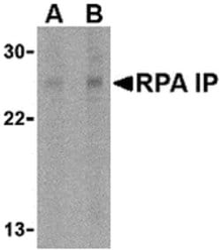 Invitrogen RPAIN Polyclonal Antibody 100 &mu;g; Unconjugated:Antibodies