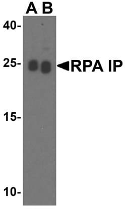 Invitrogen RPAIN Polyclonal Antibody 100 &mu;g | Buy Online | Invitrogen&trade; | Fisher Scientific