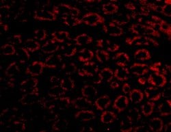 Invitrogen Nephrin Polyclonal Antibody 100 &mu;g; Unconjugated:Antibodies,