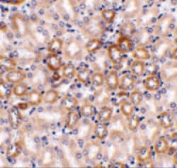 Invitrogen Nephrin Polyclonal Antibody 100 &mu;g; Unconjugated:Antibodies,