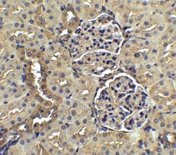 Invitrogen Nephrin Polyclonal Antibody 100 &mu;g; Unconjugated:Antibodies,