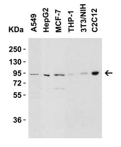 Invitrogen Nephrin Polyclonal Antibody 100 &mu;g; Unconjugated:Antibodies,