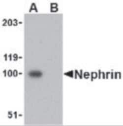 Invitrogen Nephrin Polyclonal Antibody 100 &mu;g; Unconjugated:Antibodies,