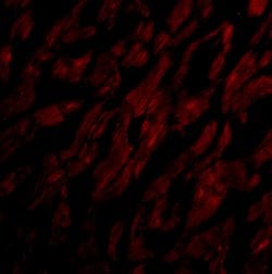 Invitrogen CRTH2 Polyclonal Antibody 100 &mu;g | Buy Online | Invitrogen&trade; | Fisher Scientific