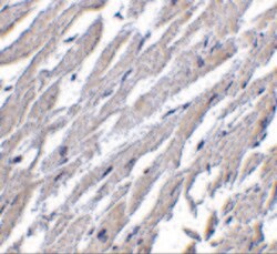 Invitrogen CRTH2 Polyclonal Antibody 100 &mu;g | Buy Online | Invitrogen&trade; | Fisher Scientific