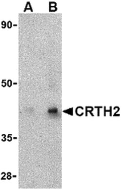 Invitrogen CRTH2 Polyclonal Antibody 100 &mu;g | Buy Online | Invitrogen&trade; | Fisher Scientific