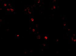 Invitrogen MDA5 Polyclonal Antibody 100 &mu;g; Unconjugated:Antibodies,