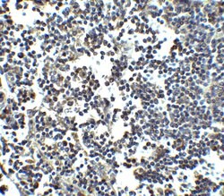 Invitrogen MDA5 Polyclonal Antibody 100 &mu;g; Unconjugated:Antibodies,