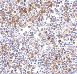 Invitrogen MDA5 Polyclonal Antibody 100 &mu;g; Unconjugated:Antibodies,