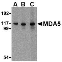 Invitrogen MDA5 Polyclonal Antibody 100 &mu;g; Unconjugated:Antibodies,