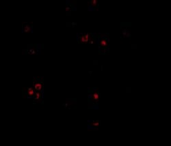 Invitrogen MDA5 Polyclonal Antibody 100 &mu;g | Buy Online | Invitrogen&trade; | Fisher Scientific