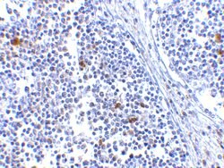 Invitrogen MDA5 Polyclonal Antibody 100 &mu;g | Buy Online | Invitrogen&trade; | Fisher Scientific